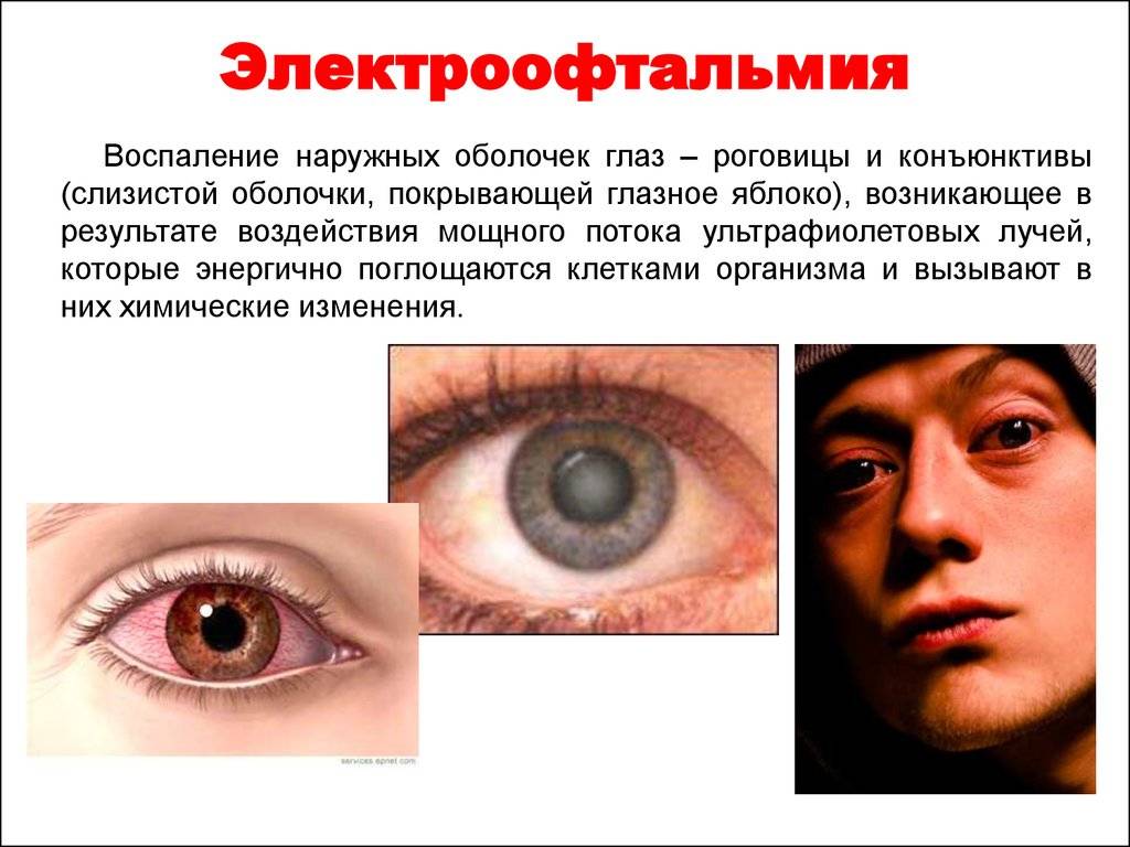 Скотома глаза: что это такое, причины, симптомы, фото, лечение, виды выпадения полей зрения (мерцающая, центральная, абсолютная, относительная, функциональная, парацентальная, бьеррума, глазная мигрень)