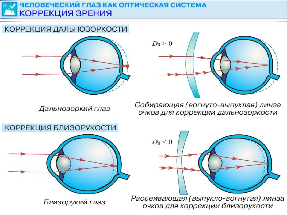 Рефракция глаза у детей: что это такое, как определить