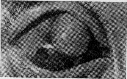Конъюнктива глаза: что это такое, симптомы и лечение патологий