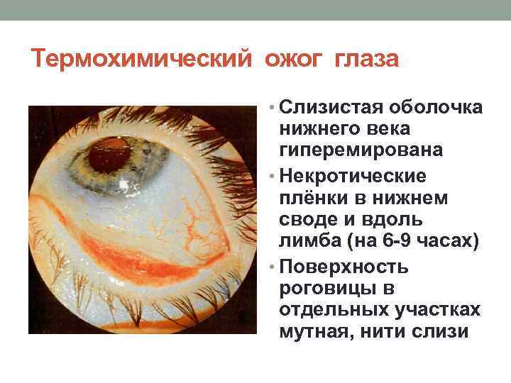 Травма глаза: лечение, классификация, последствия