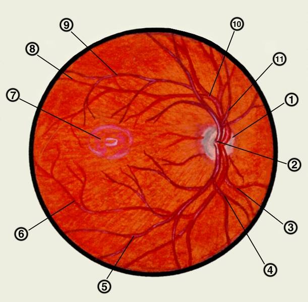 Макулодистрофия сетчатки глаза: лечение влажной и сухой формы