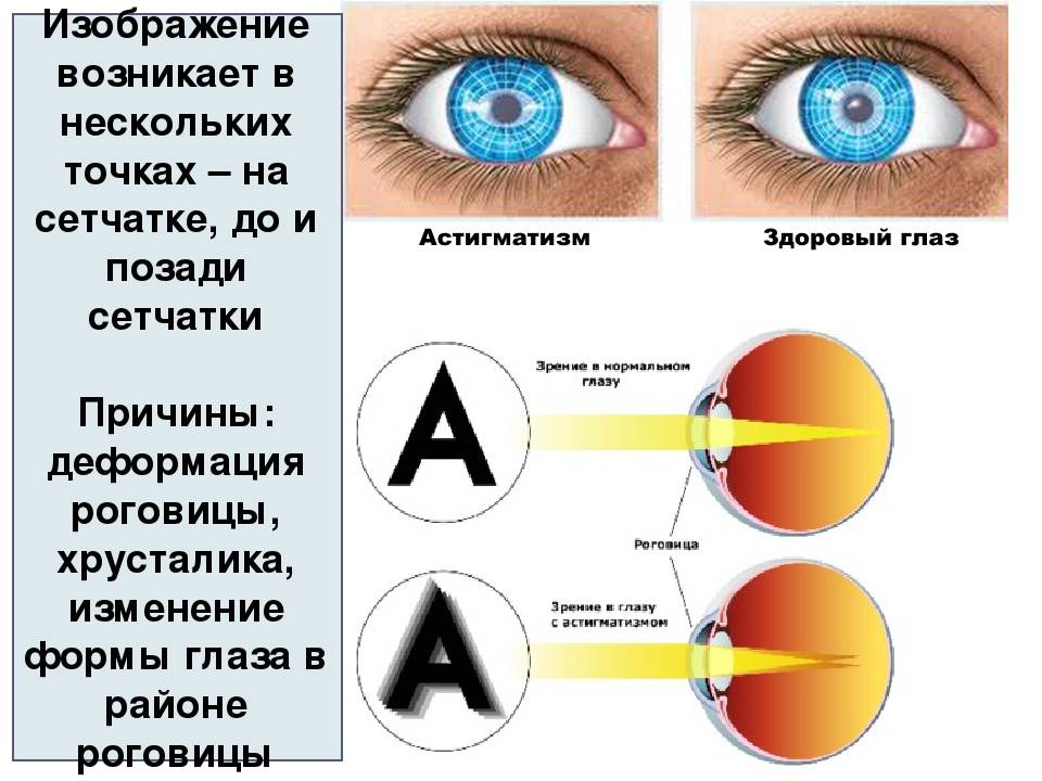 Глаз 0. Нарушение органов зрения. Заболевания органов зрения презентация. "Нарушение органов зрения" болезни. Болезни органов зрения и их профилактика.