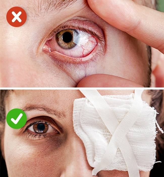 Что делать, если в глаз попал шампунь: опасно ли это, как предотвратить попадание шампуня в глаза
