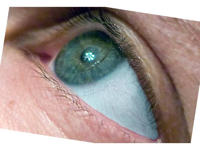 Склеральные линзы с диоптриями в москве. купить склеральные линзы на весь глаз. контактные линзы для лечения кератонуса. жесткие контактные линзы. цена. подбор.
