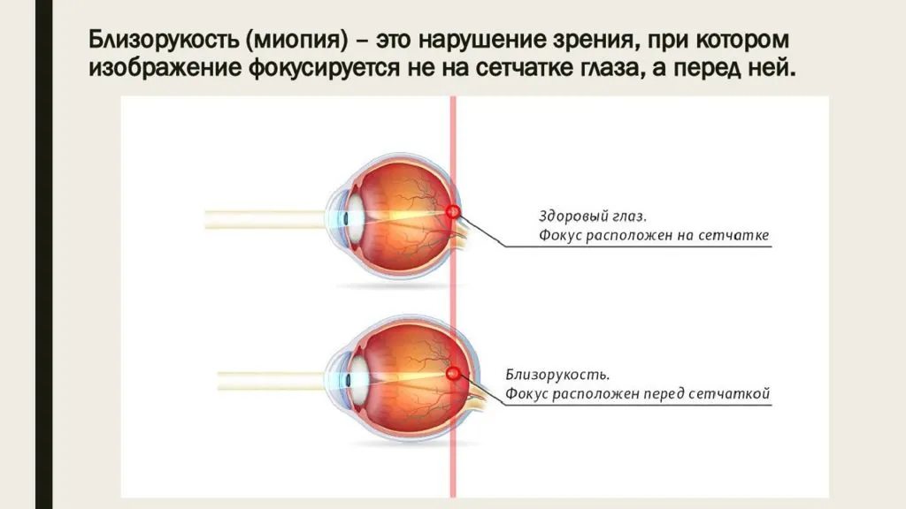 Центральное зрение - что это, методы исследования