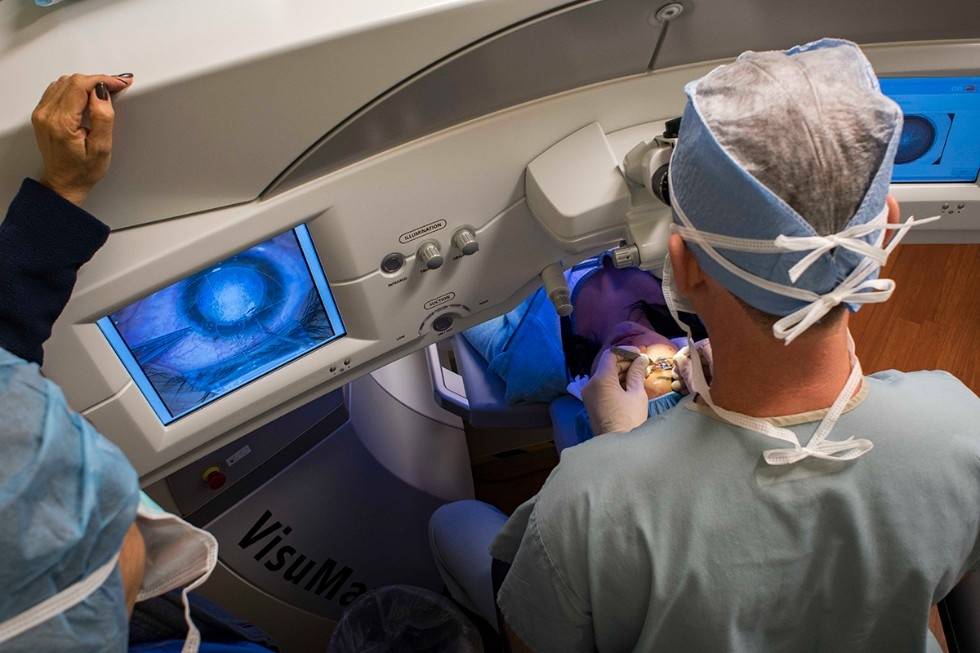 Астигматизм — последствия после лазерной коррекции, противопоказания к операции — глаза эксперт
