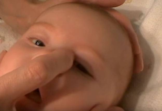 Закисание глаз у новорожденных и малышей: причины и лечение