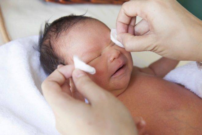 Ззондирование слезного канала у новорожденных - как делают