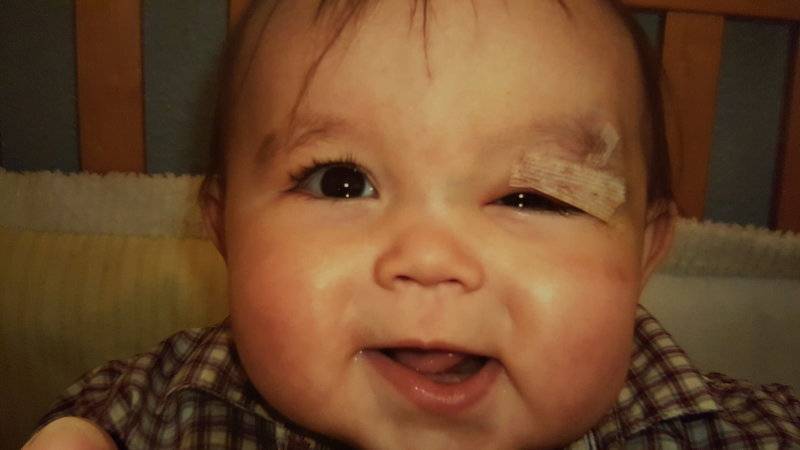 Гемангиома у новорожденных детей (18 фото): причины и лечение, на голове и затылке грудничка, лице, губе и печени, ноге, спине или руке, комаровский