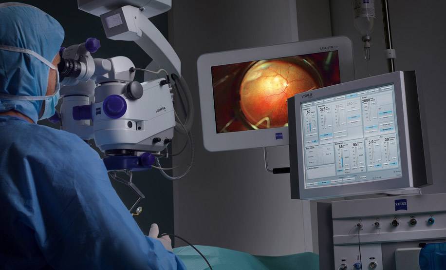 Операция при отслоении сетчатки глаза - проведение хирургического вмешательства, что нельзя делать после лечения лазером