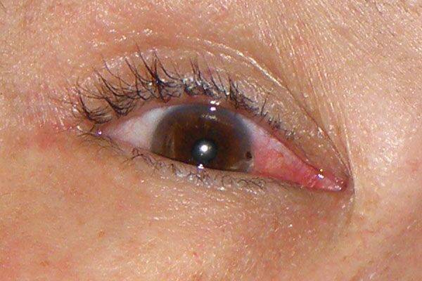 Пандемия коронавируса и глаза: может ли быть заражение таким путем, как себя обезопасить