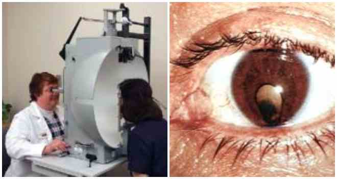 Отслоение сетчатки глаза - что это, симптомы, лечение, фото, причины