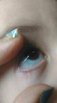 Голубой белок глаза что означает. почему у ребенка серые белки глаз