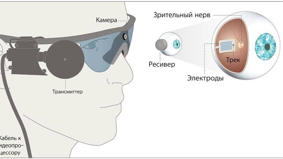 Искусственный бионический глаз - зрительная система будущего