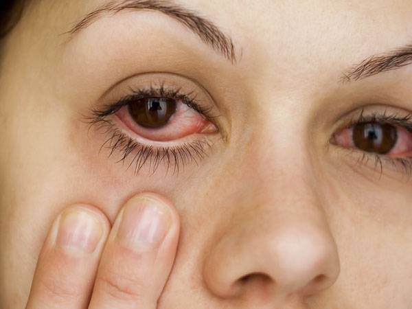 Глаз покраснел и болит: первая помощь при покраснении