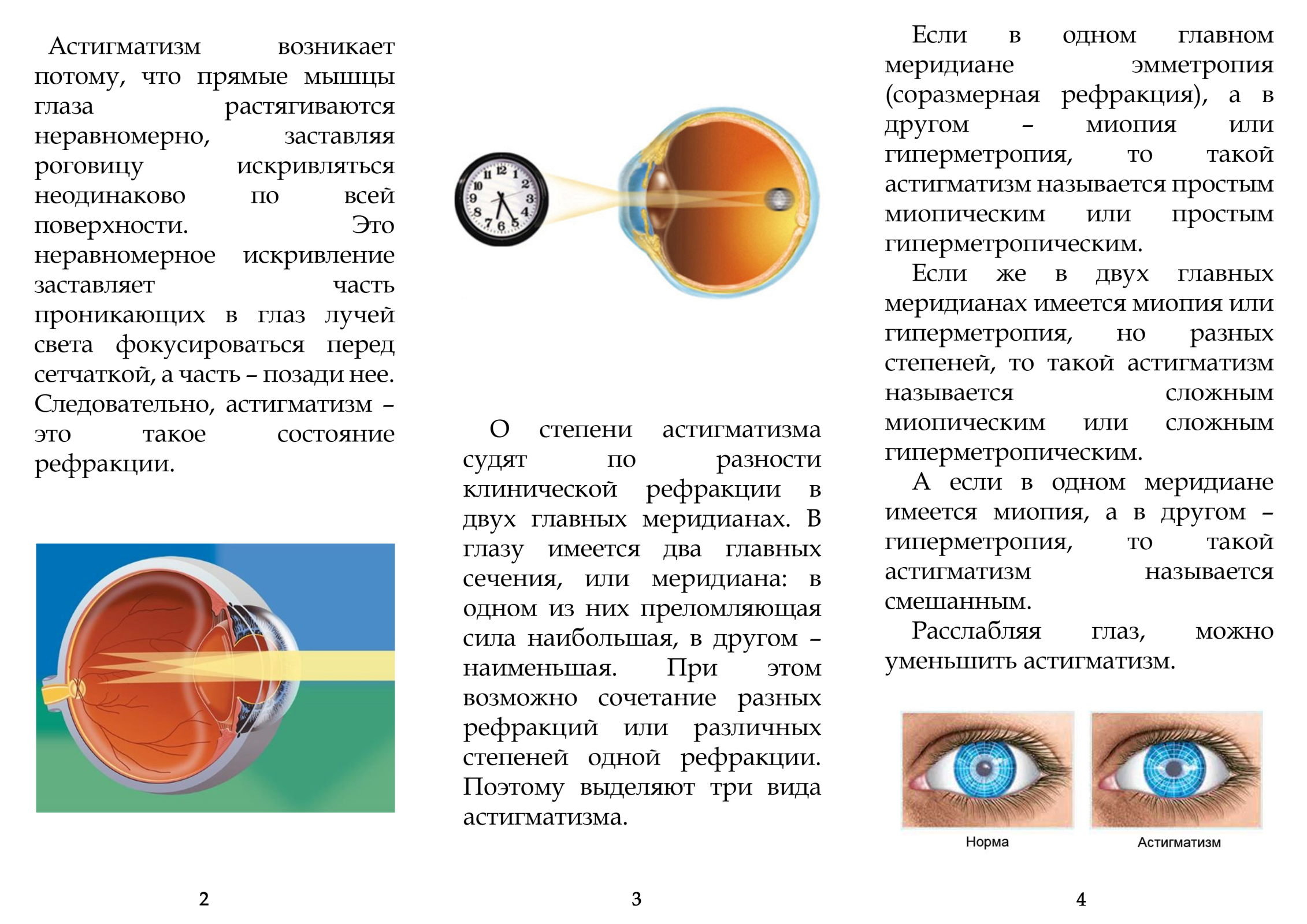 Сложный гиперметропический астигматизм обоих глаз у детей
