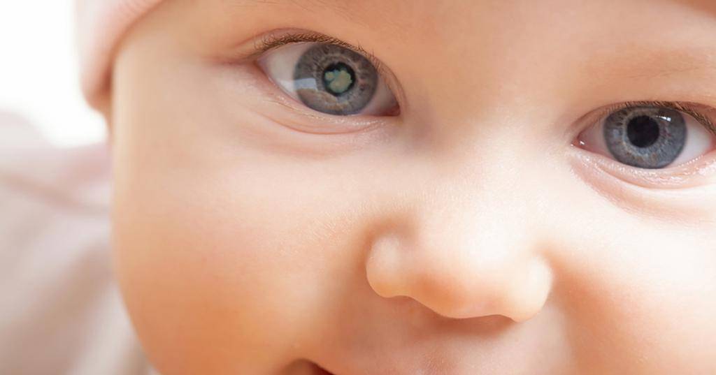 Почему развивается врожденная глаукома? две главные причины повышения вгд у новорожденных