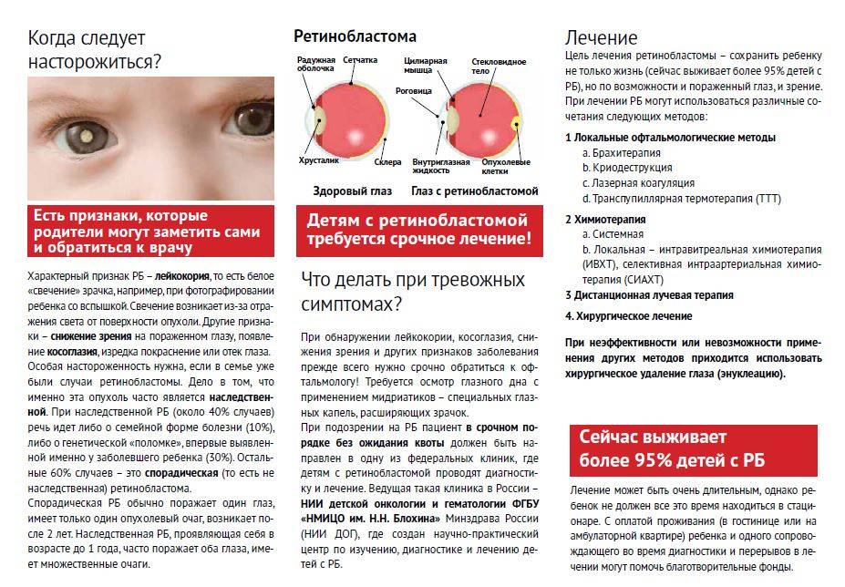 Ретинобластома глаза у детей и взрослых: что это такое, причины развития, симптомы и признаки начальной стадии, прогноз
