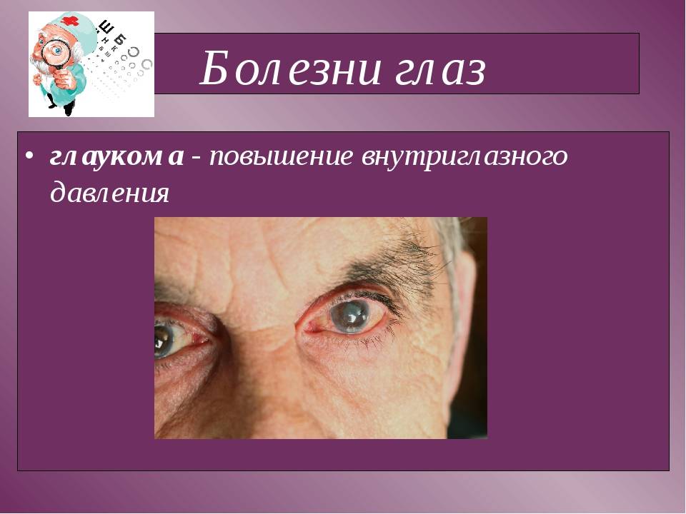 Болезни глаз: список патологий, которые возникают у человека, медицинские и народные названия