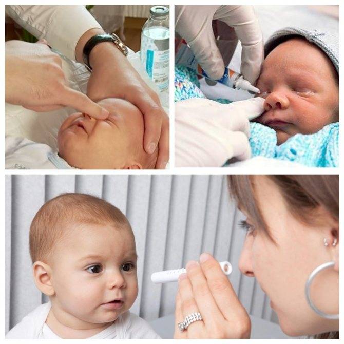 Массаж слезного канала у новорожденных. как правильно делать. советы врачей