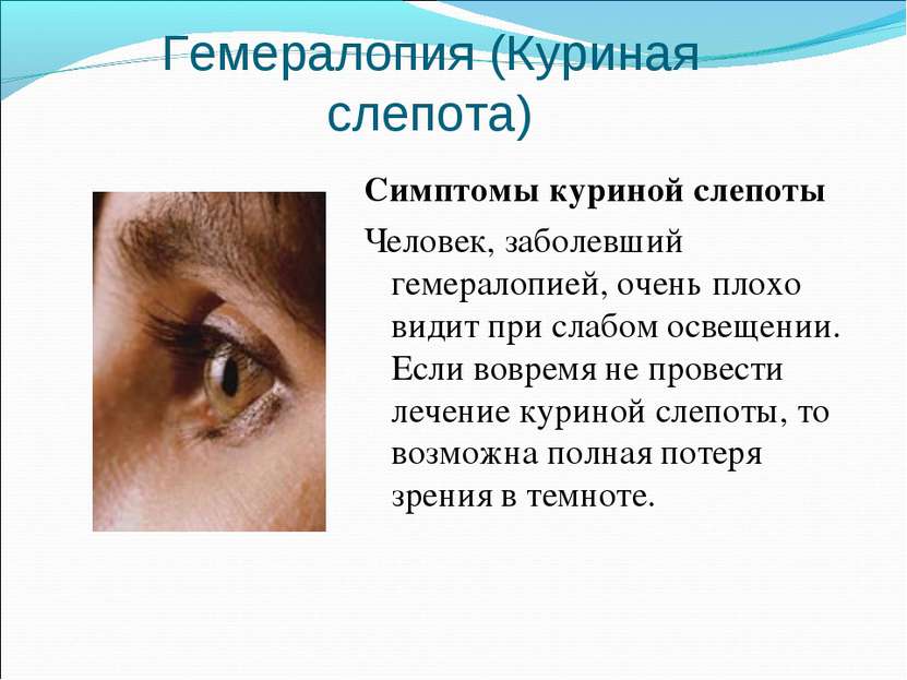 Куриная слепота у человека (гемералопия): симптомы, когда плохо видишь в темноте, причины, виды, диагностика, лечение (витамины, питание, народные средства)