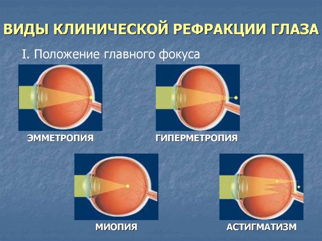 Рефрактометрия глаза: описание, показания, нормы рефрактометрии и расшифровка результатов