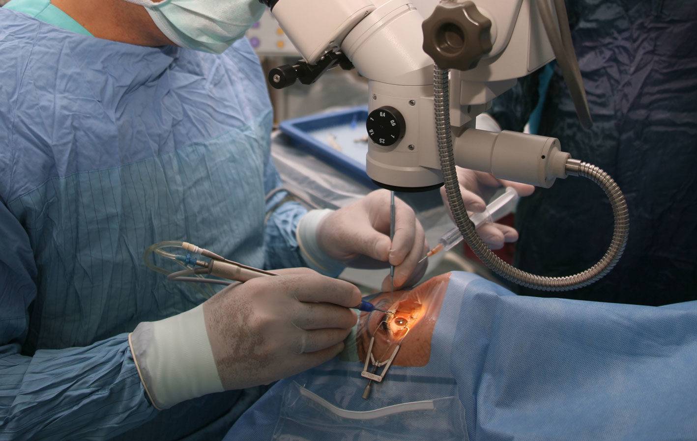 Лечение глаукомы лазером: плюсы и минусы операции