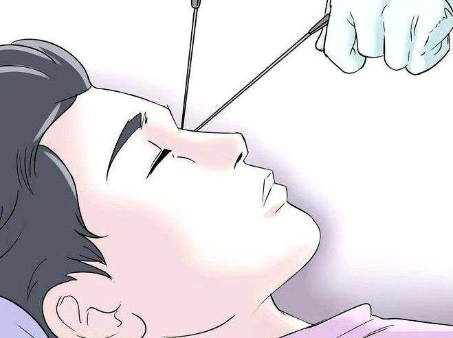 Дакриоцисториностомия: что это за операция, методы проведения лазером и эндоскопическая - головная боль