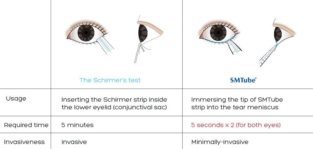 Тест ширмера для определения синдрома "сухого глаза", результаты