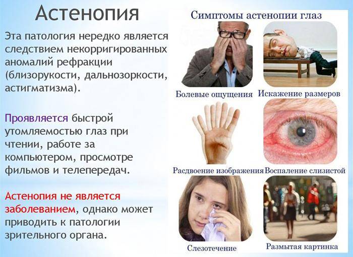Астенопия глаз: что это такое и как лечить
