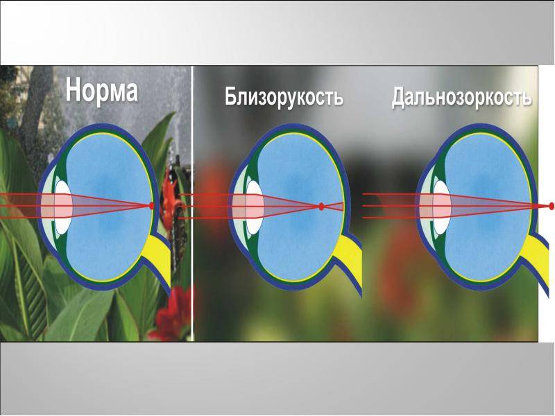 Какие очки подобрать для коррекции близорукости и дальнозоркости одновременно?