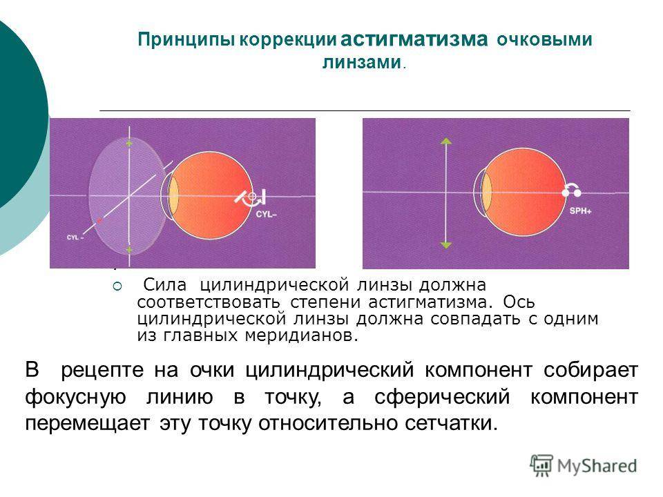 Коррекция астигматизма. Линзы цилиндры для астигматизма. Ось 90 при астигматизме линзы. Принципы коррекции астигматизма. Ось цилиндрической линзы.