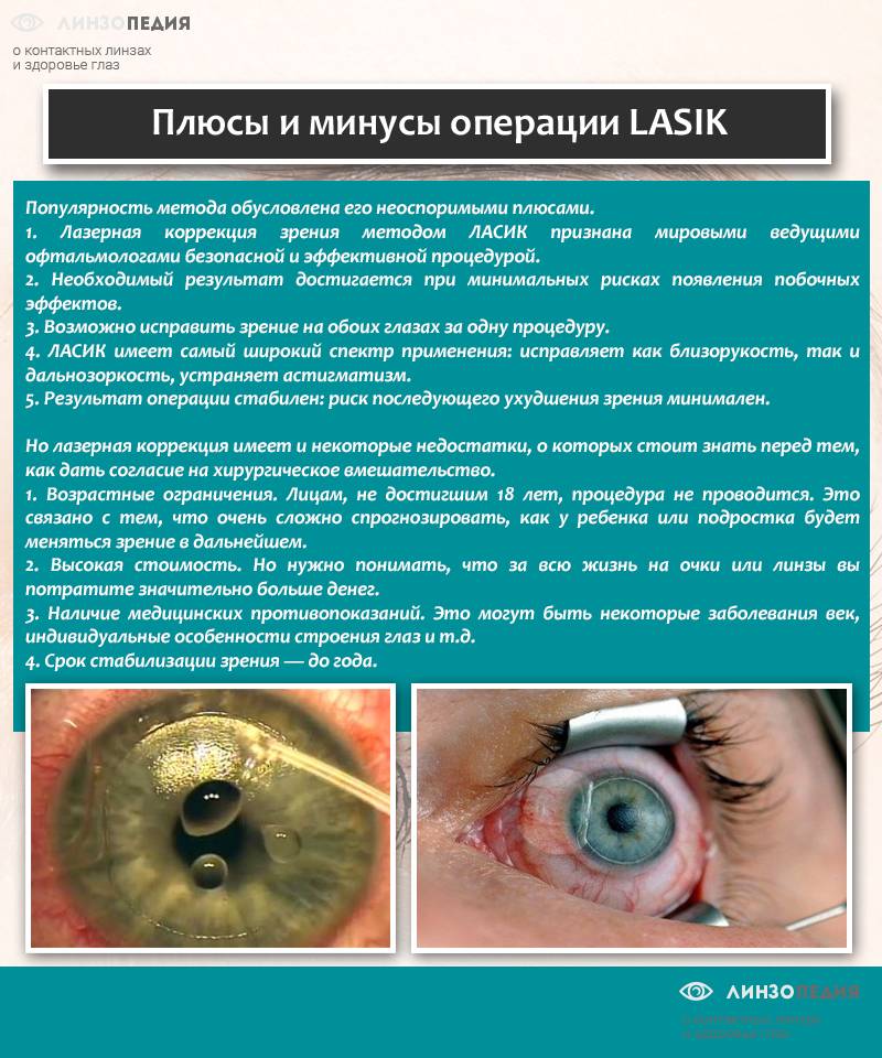 Лазерная коррекция зрения - больно ли это,операция и реабилитация