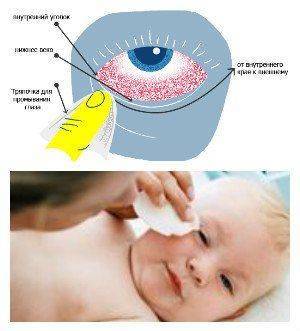 Как правильно промыть глазки малышу