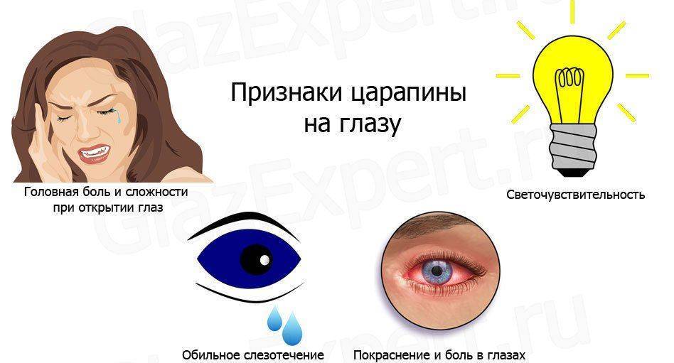 Симптомы поцарапанного глаза