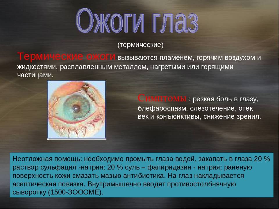 От сварки болят глаза - что делать? чем лечить ожог сетчатки глаза - sammedic.ru