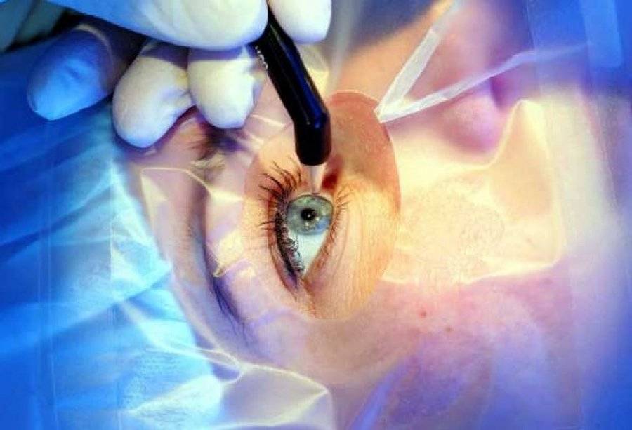 Операция по удалению глазного яблока