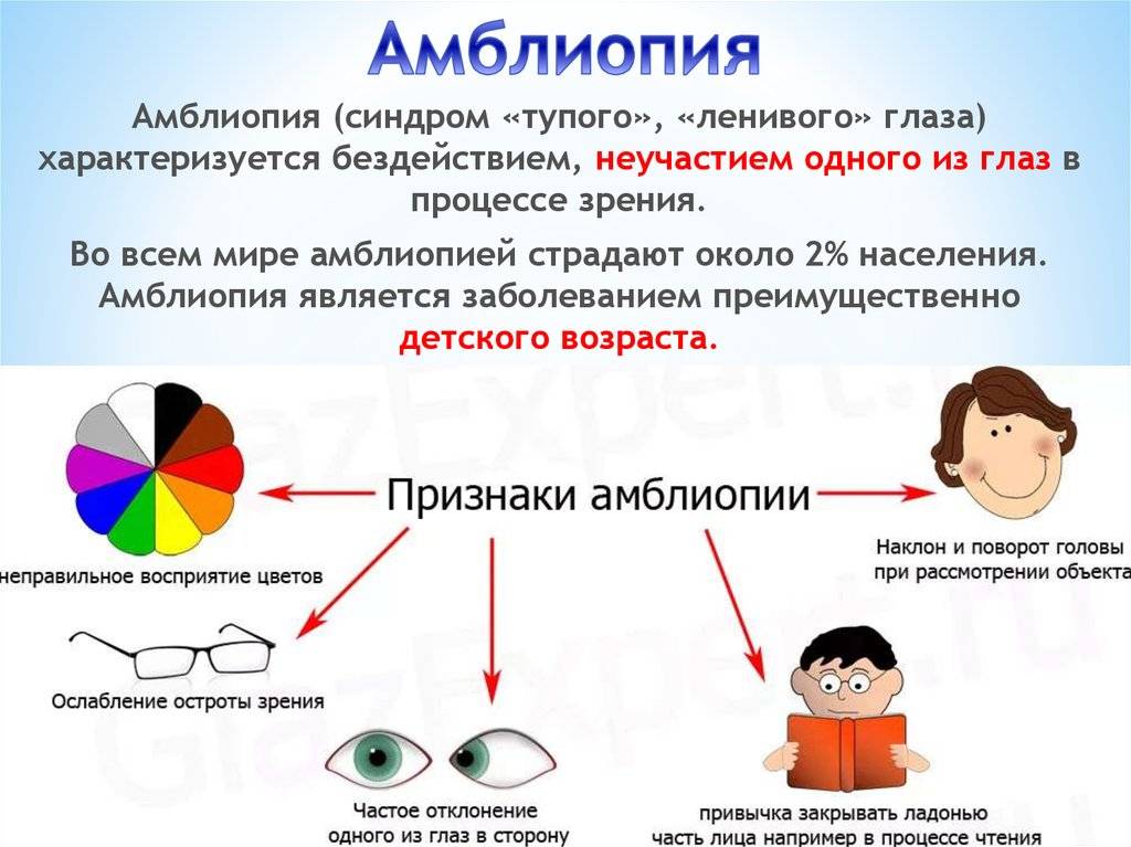 Амблиопия или ленивый глаз: симптомы, лечение - "здоровое око"