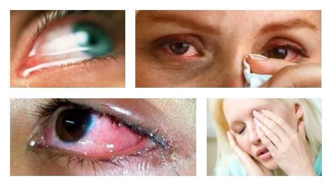 Резь в глазах: возможные причины, профилактика и лечение - "здоровое око"