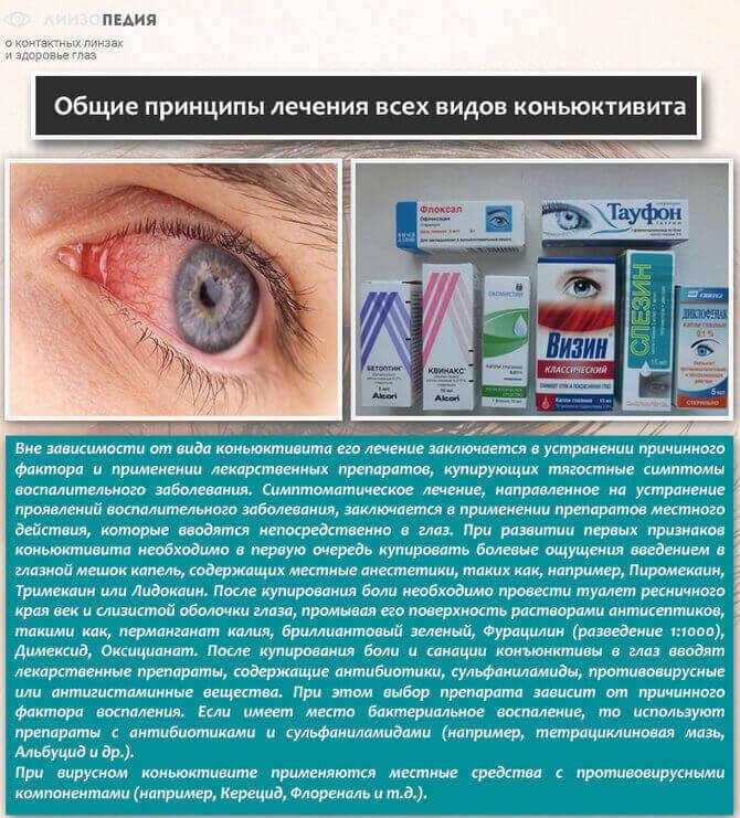 Глазные мази от конъюнктивита для детей