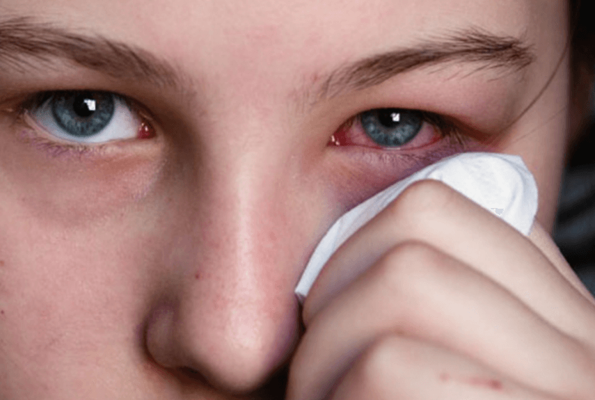 Слезится глаз – причины и лечение у взрослых, если текут слезы сами по себе