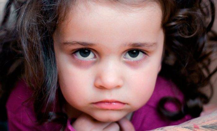 Синяки под глазами у ребёнка: причины, почему появляются круги