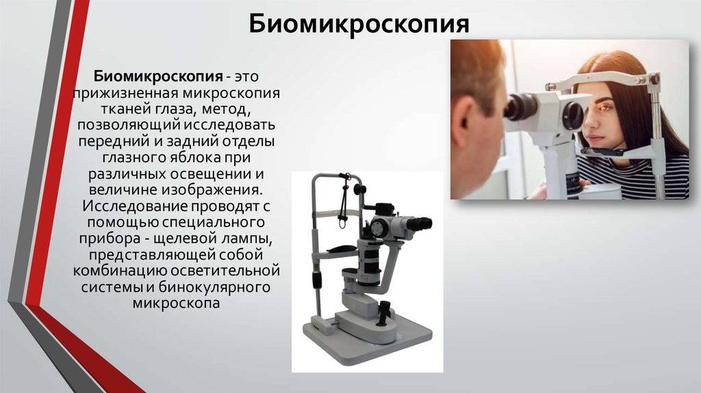О биомикроскопии глаза подробно