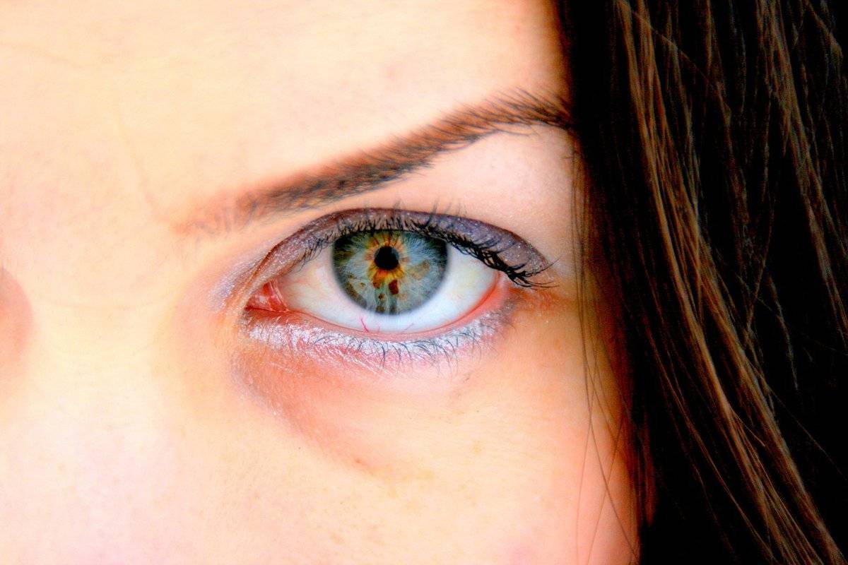 Гетерохромия глаз: причины и классификация - "здоровое око"