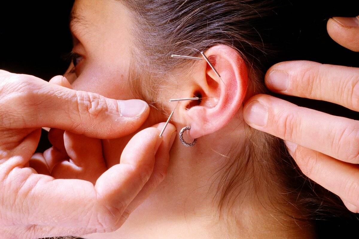 Прокол ушей – польза и вред. как правильно сделать? осложнения