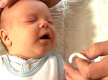 Зондирование слезного канала у новорожденных. что это, как проводится, видео, последствия операции, отзывы