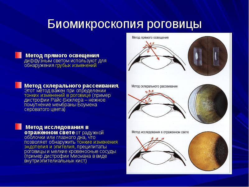 Биомикроскопия глаза - симптомы и лечение. журнал медикал