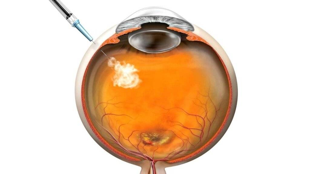 Препараты для укрепления сетчатки глаза