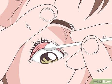 Что делать если в глаз попала соринка и как достать?