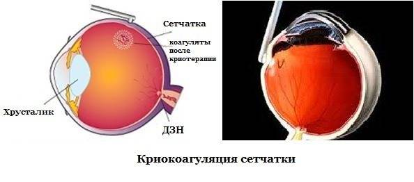 Витамины для сетчатки глаза - лучшие препараты и природные источники!